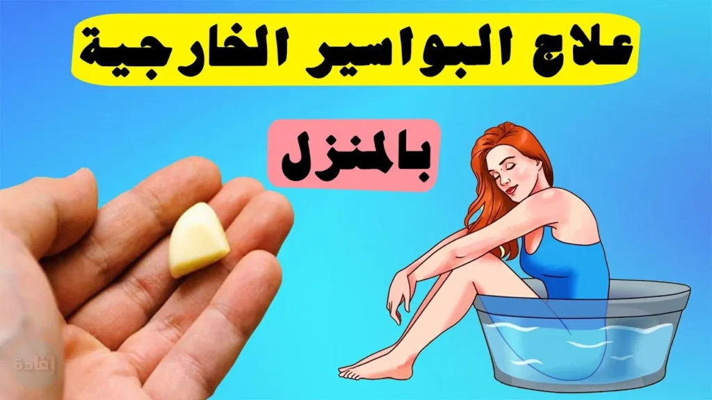 علاج البواسير
