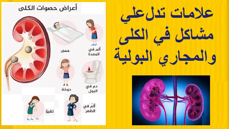 تنظيف الكلى من الحجارة